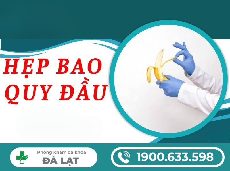 Hình ảnh minh họa